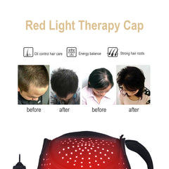 216-LED Red Light Therapy Hat for Hair Growth, Dual Wavelength 660nm & 850nm Cap