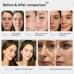 Comprehensive Anti-Aging Treatment:4-Color LED Light Therapy Silicone Mask for Face and Neck Firming and Brightening, 480 LED Beads