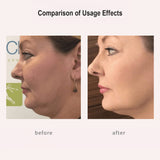 FREYARA HIFU - FacialDefy 3.0 Lite, HIFU 2in1 Eye&Facial Microfocused Ultrasound Machine,Stimulate Collagen Production,Reduce Wrinkles