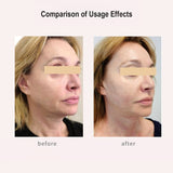 FREYARA HIFU - FacialDefy 3.0 Lite, HIFU 2in1 Eye&Facial Microfocused Ultrasound Machine,Stimulate Collagen Production,Reduce Wrinkles
