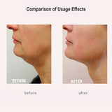FREYARA HIFU - FacialDefy 3.0 Lite, HIFU 2in1 Eye&Facial Microfocused Ultrasound Machine,Stimulate Collagen Production,Reduce Wrinkles