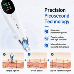 FREYARA LASER FacialPure Pro, Home-Use Wireless Picosecond Laser Pen with Blue Light Positioning, Suitable for Fade Tattoos and Dark Spots