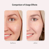 FREYARA HIFU - FacialDefy 3.0 Lite, HIFU 2in1 Eye&Facial Microfocused Ultrasound Machine,Stimulate Collagen Production,Reduce Wrinkles