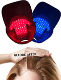 Laser Light Therapy Cap for Hair Growth with 70 LED lamp, Hair Regrowth System for Men and Women, Red and Blue Light Therapy