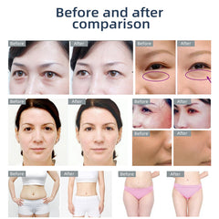 Mini 3in1 RF Beauty Device Rejuvenation Lifting Wrinkle Removal Skin Tightening for Face Eye Skin