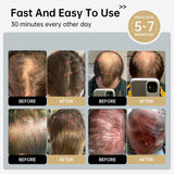 120 LLLT Laser Therapy Cap,Highly Focused Energy, Directly Reaching The Root of The Hair Follicle (5-8mm),Hair Regrowth Device