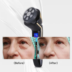 FREYARA HIFU - FacialDefy 2.0, Handheld and Portable HIFU 4in1 Microfocused Ultrasound Machine,Upgraded Power, Faster Lift, Visible Results