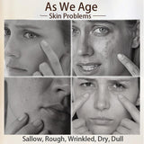 FREYARA DPL+NIR - Photofacial 1.0, Professional Milk Light Photofacial Device,Erase Spots, Lift Skin&Anti-aging at Home