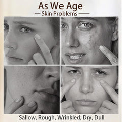 FREYARA DPL+NIR - Photofacial 1.0, Professional Milk Light Photofacial Device,Erase Spots, Lift Skin&Anti-aging at Home