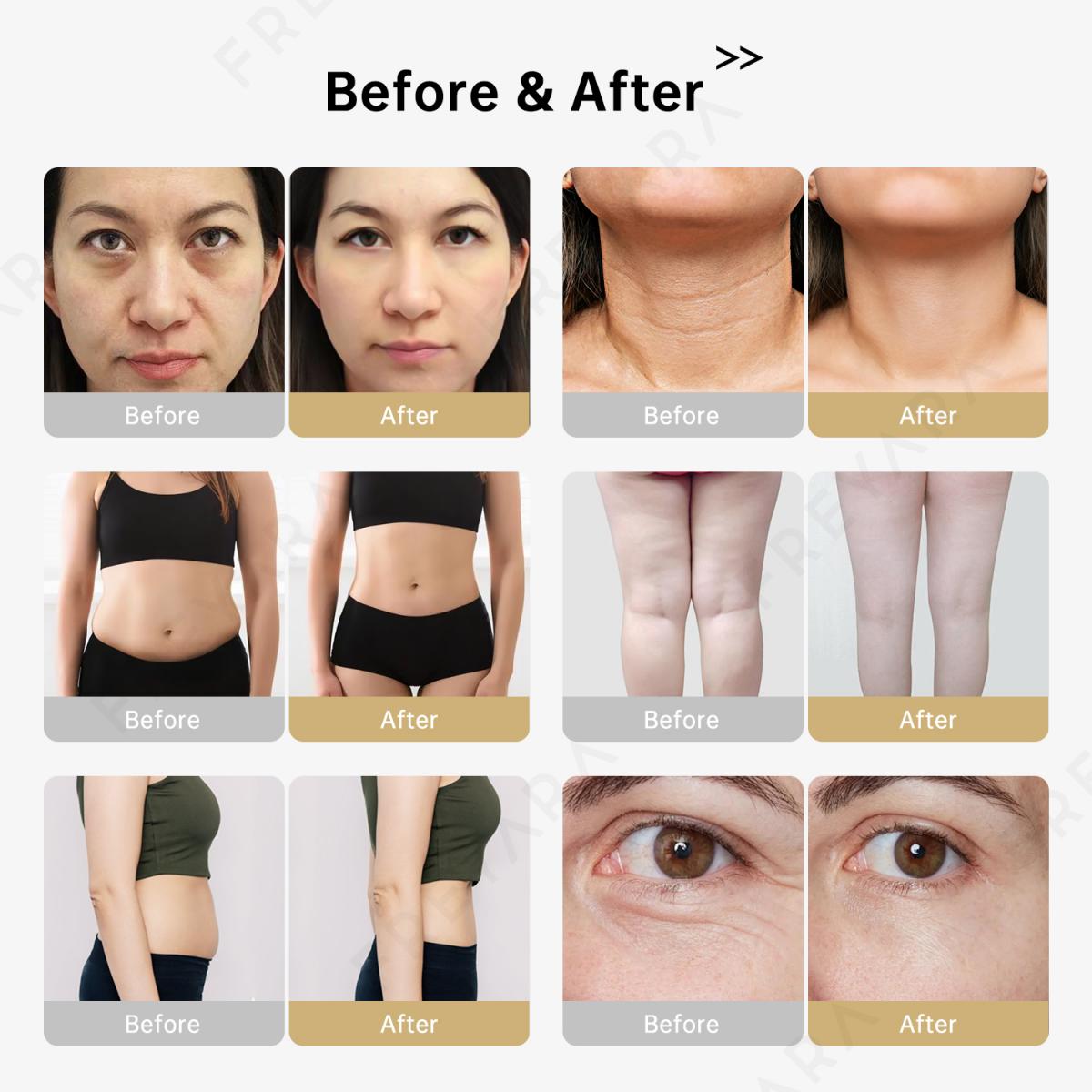 3in1 40K RF Ultrasonic Cavitation Machine, Body Sculpting Slimming Device, 3 Massage Heads for Belly Fat, Waist, Arm, Leg, Butt