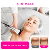 4in1 40K RF Vacuum Ultrasonic Cavitation Machine, Fat Burning Body Slimming Sculpting Device for Face, Arm, Waist, Belly, Leg