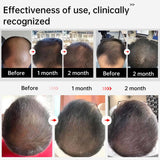 120 LLLT Laser Therapy Cap,Highly Focused Energy, Directly Reaching The Root of The Hair Follicle (5-8mm),Hair Regrowth Device