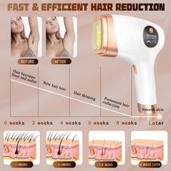 IPL Laser Hair Removal Permanent at Home, Ice Painless for Full Body, 999999 Flashes, 5 Levels, FDA Certified, UK Plug