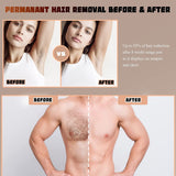 IPL Laser Hair Removal Permanent at Home, Ice Painless for Full Body, 999999 Flashes, 5 Levels, FDA Certified, UK Plug