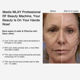 MLAY Professional RF Beauty Machine for Lifting, Toning, Wrinkle Removal, Facial and Body Skin Tightening